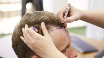 vucut-kil-sac-ekimi-6989f947ba222